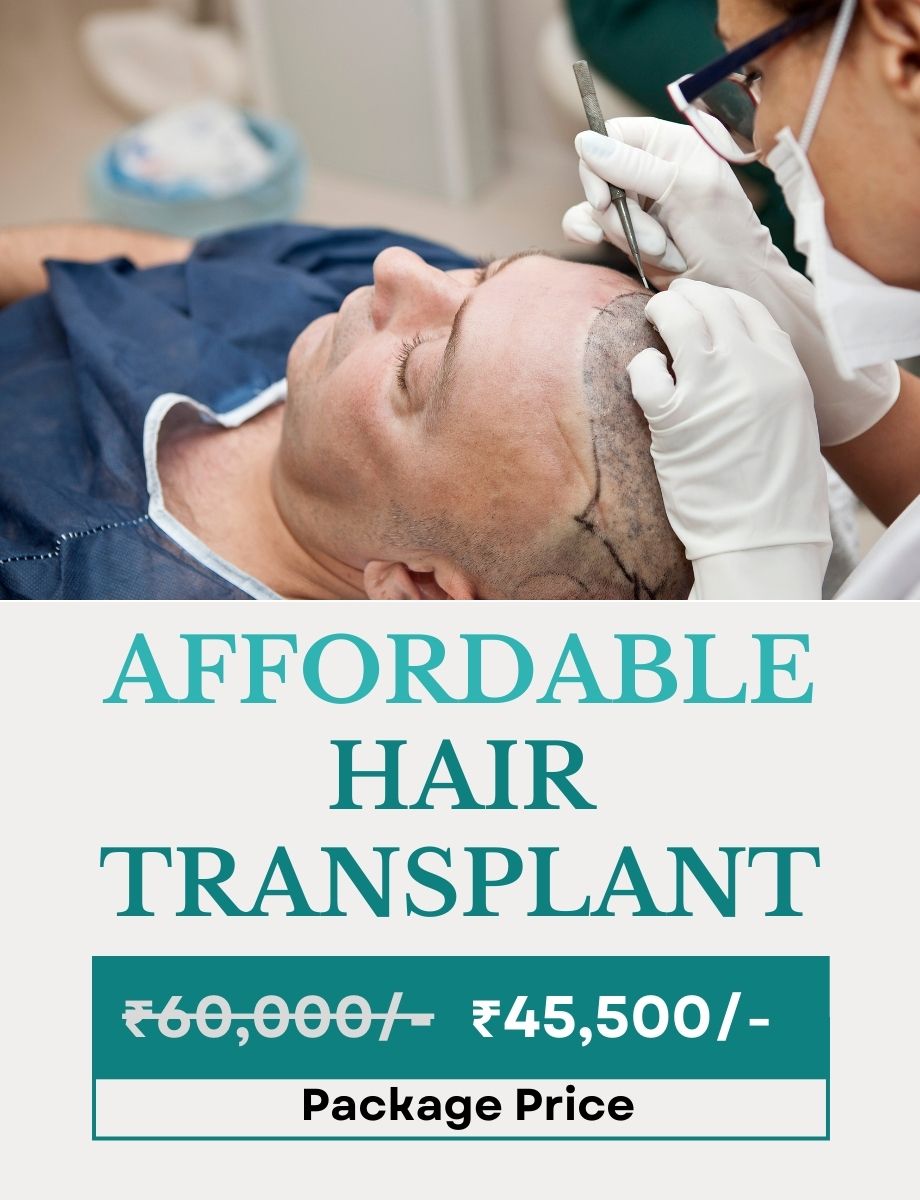 Hair Transplant Offer for Men Esthetica Clinic - Mobile Vrsion